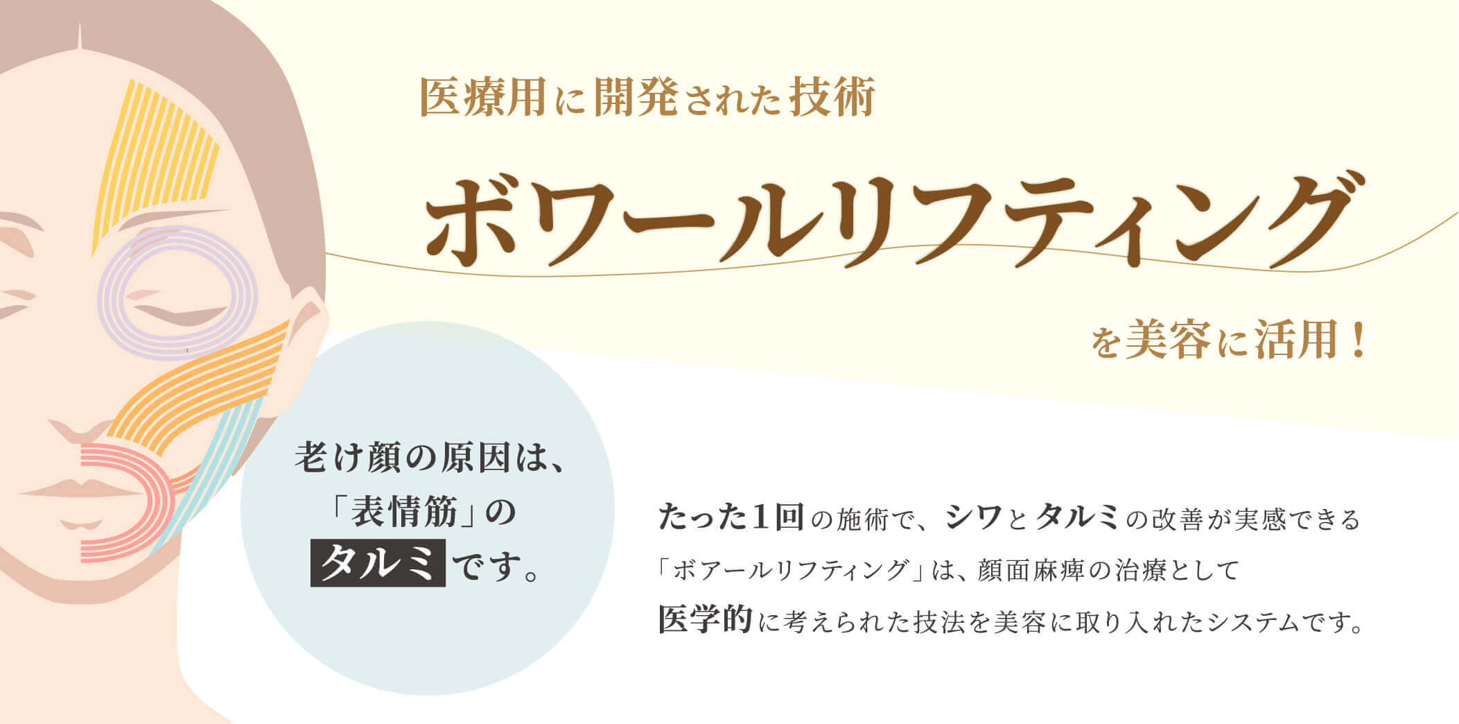 ボワールリフティング